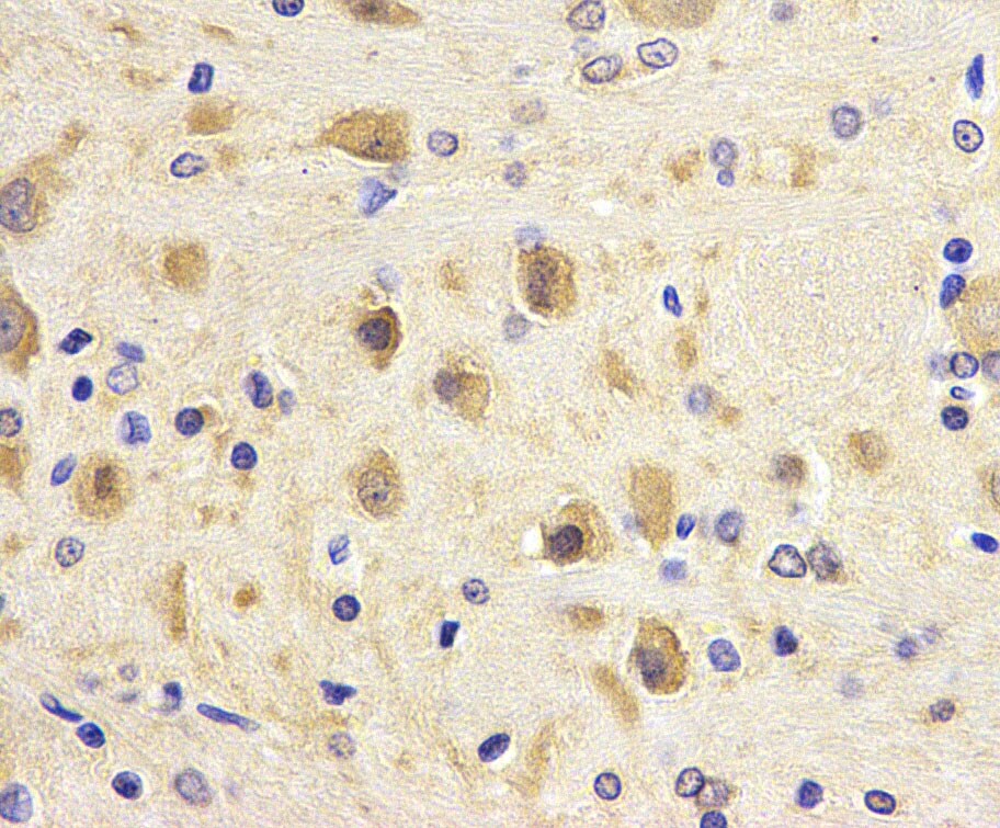 LC3B Antibody - BSA Free NB100-2220