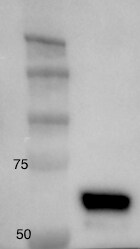 hnRNP K Antibody NBP2-24531