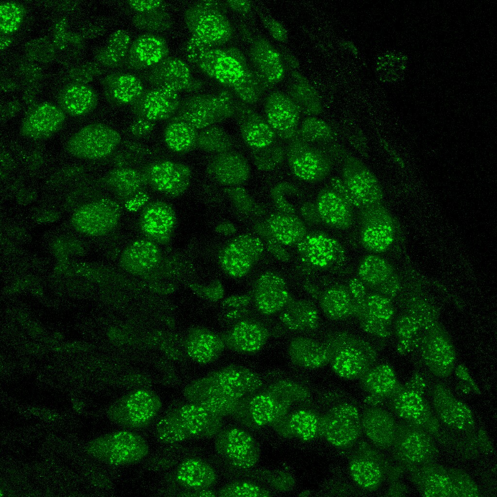 53BP1 Antibody - BSA Free NB100-304