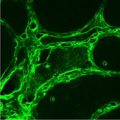 LRRK2 Antibody - BSA Free NB300-268