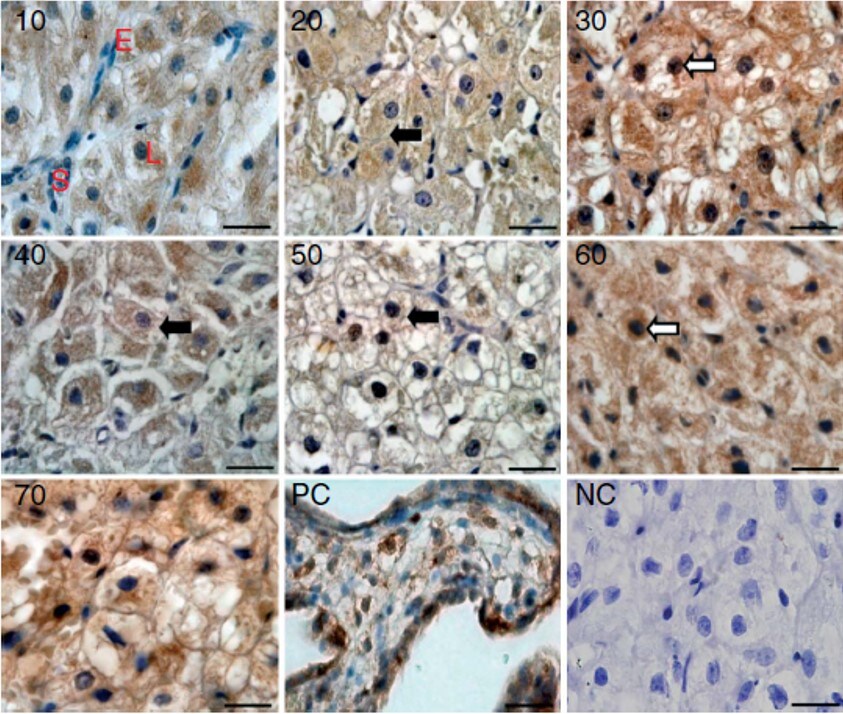 HIF-1 alpha Antibody - BSA Free NB100-134