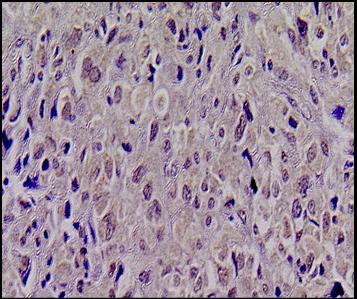 KMT1A/SUV39H1 Antibody NBP1-21367