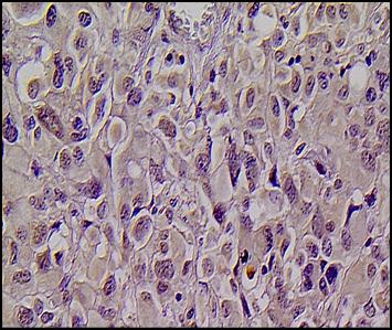 KMT1A/SUV39H1 Antibody NBP1-21367