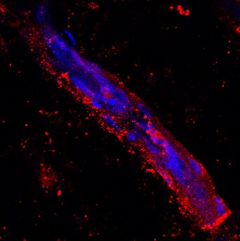 LYVE-1 Antibody - Azide and BSA Free NB600-1005