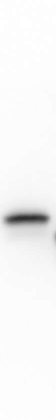 TRAP alpha Antibody (OTI4C7) NBP2-01026
