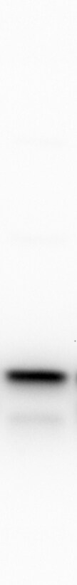 Signal sequence receptor delta Antibody - BSA Free NBP1-92390