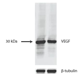 VEGF Antibody (VG1) - BSA Free NB100-664