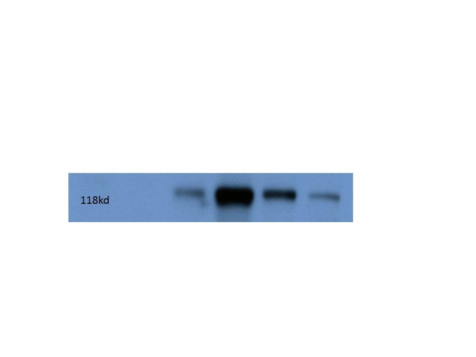 Kinesin 5A Antibody - BSA Free NBP1-76816