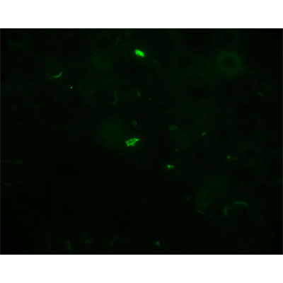 LPCAT1 Antibody - BSA Free NBP1-88923