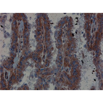 RAP1B Antibody NBP2-20072