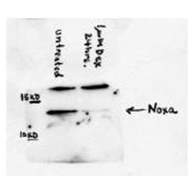 Noxa Antibody (114C307.1) - Non-Recombinant Monoclonal NB600-1159