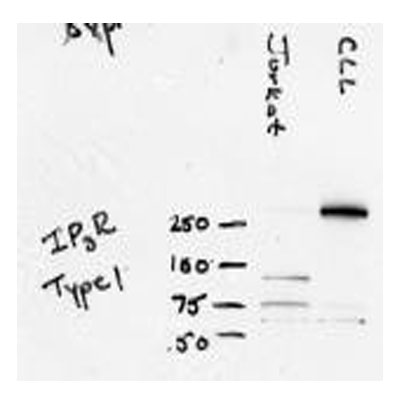 IP3R1 Antibody NB120-5908