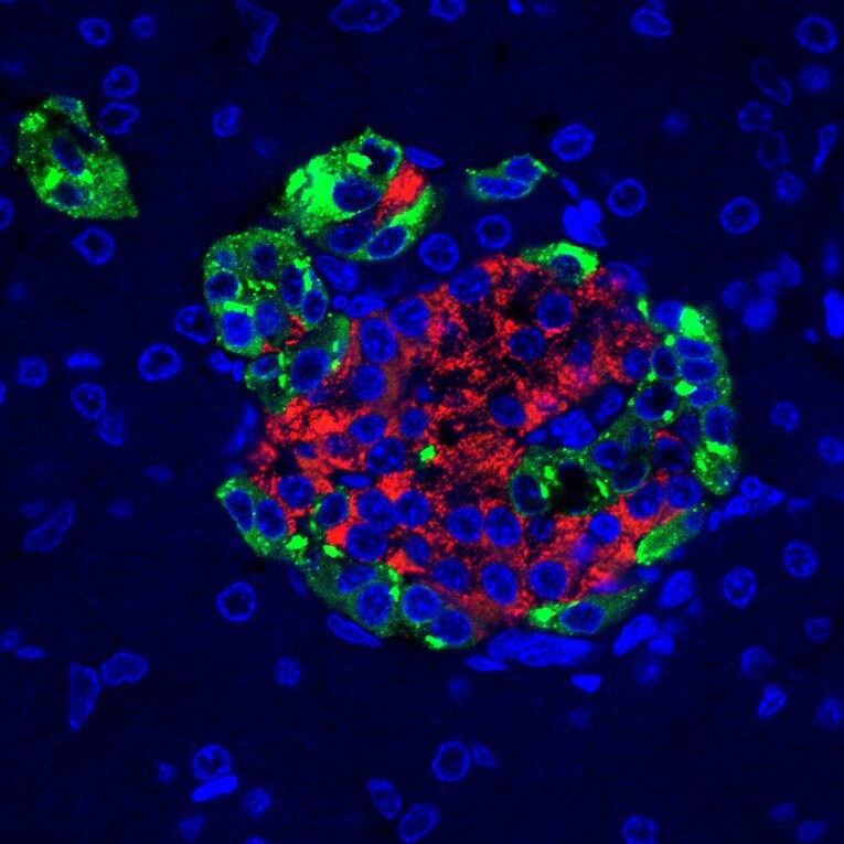 Pancreatic Polypeptide/PP Antibody NB100-1793