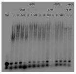 Recombinant Human POT1 GST (N-Term) Protein H00025913-Q01