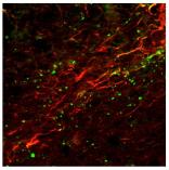 NK1R Antibody - Azide and BSA Free NB300-101