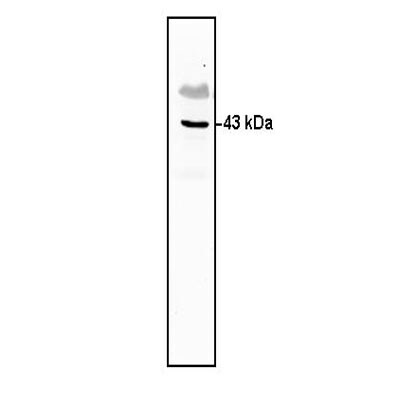 PLA2G4B Antibody (1G5) - Azide and BSA Free H00008681-M01