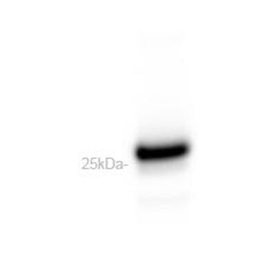 Lightning-Link (R) HRP Antibody Labeling Kit 701-0000