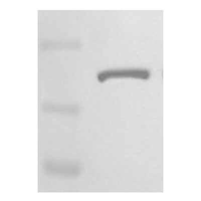 ROCK1 Antibody - BSA Free NB100-624