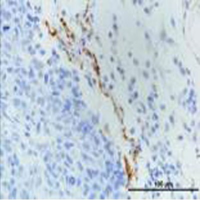 LYVE-1 Antibody [DyLight 488] NB100-725G