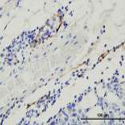 Podoplanin Antibody (8.1.1) - BSA Free NB600-1015