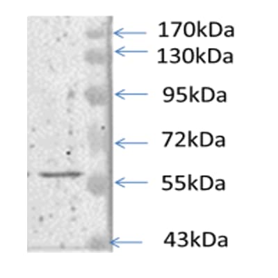 Dihydrolipoamide Dehydrogenase/DLD Antibody - BSA Free NBP1-31302