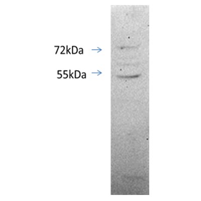 ERR beta/NR3B2 Antibody NB300-748