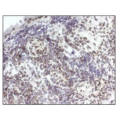 15-PGDH/HPGD Antibody - BSA Free NB200-179