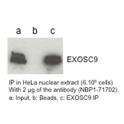 Exosome Component 9 Antibody - BSA Free NBP1-71702