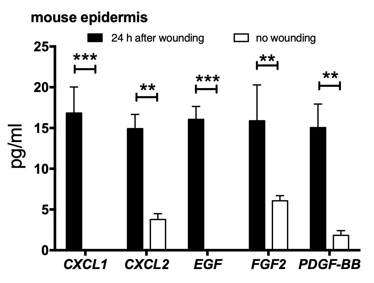 Mouse Luminex® Discovery Assay LXSAMSM