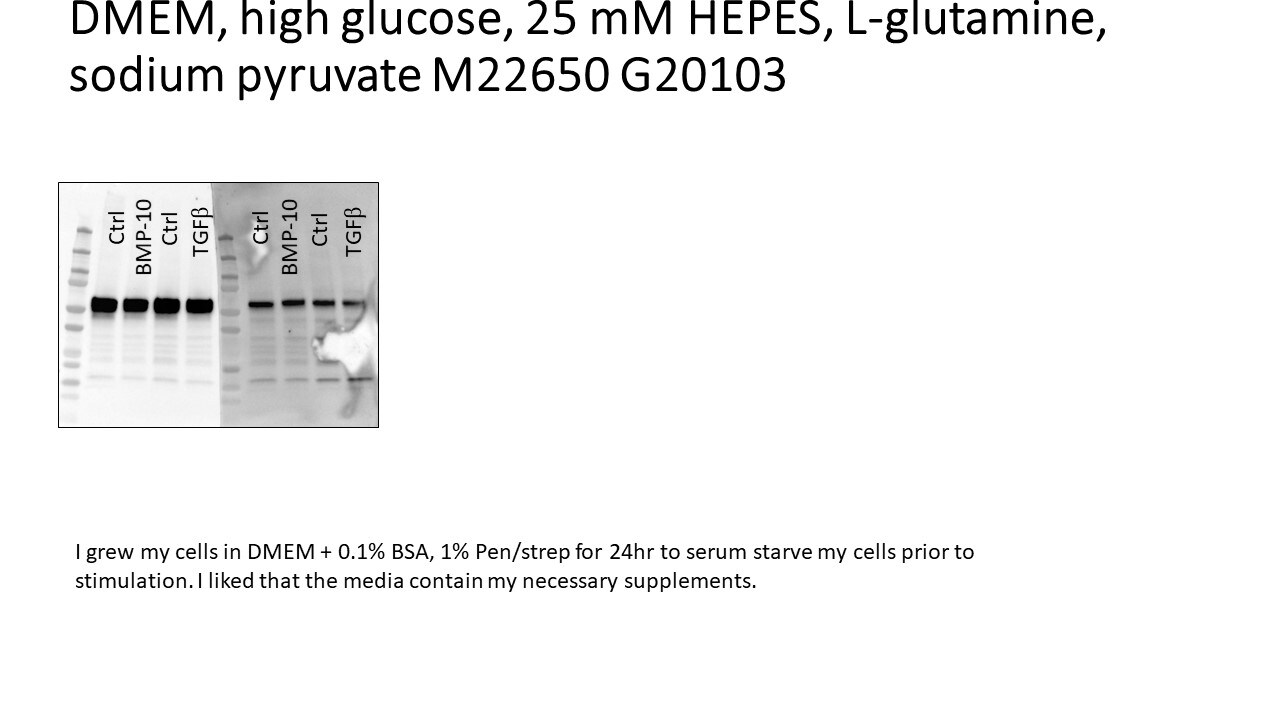 DMEM, high glucose, 25 mM HEPES, L-glutamine, sodium pyruvate M22650