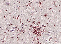 Human Neurophysin II Antibody MAB009