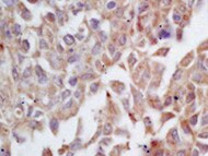 Human Fas Ligand/TNFSF6 Antibody MAB0951