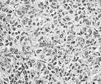 Human/Mouse Angiopoietin‑2 Antibody MAB098