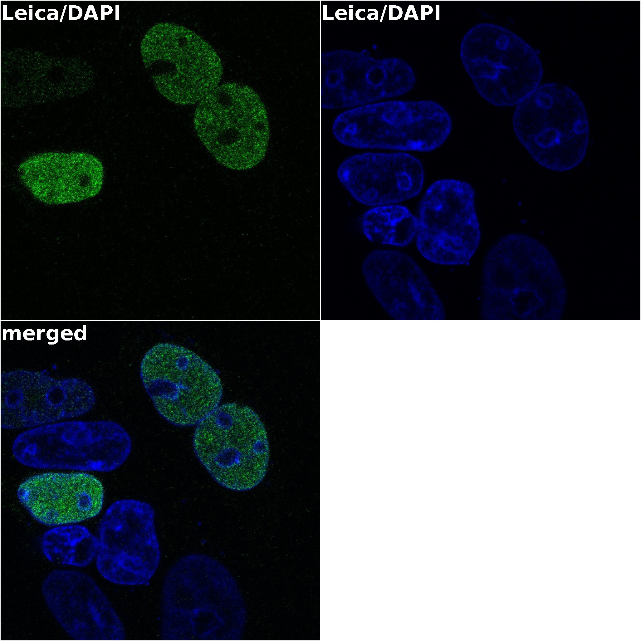NanoLuc® (Nluc) Luciferase Antibody MAB100261