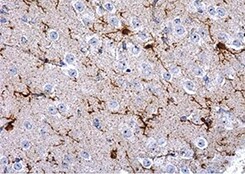 Human CETP Antibody MAB10042