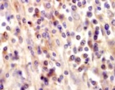 Human/Mouse PBR Antibody MAB10045