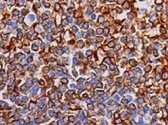 Human UNC5H3 Antibody MAB1005