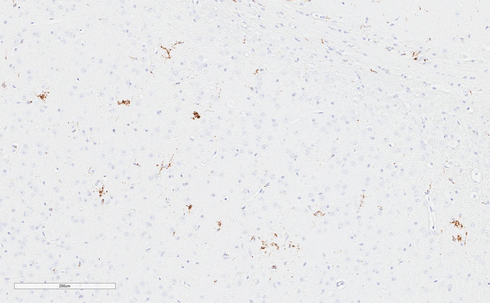 Mouse CD68/SR‑D1 Antibody MAB101141