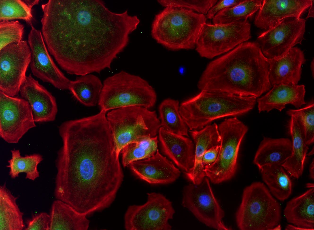 Human/Rat GR/NR3C1 Antibody MAB10144
