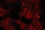 Human Cathepsin D Antibody MAB1014