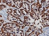 Human/Mouse/Rat ALDH2 Antibody MAB10168