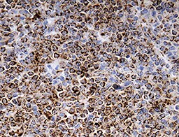 Human MT2A Antibody MAB10176