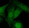 Human/Mouse/Rat Phospho-ERK1 (T202/Y204)/ERK2 (T185/Y187) Antibody MAB1018
