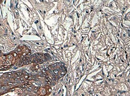 Human ABI1 Antibody MAB10249