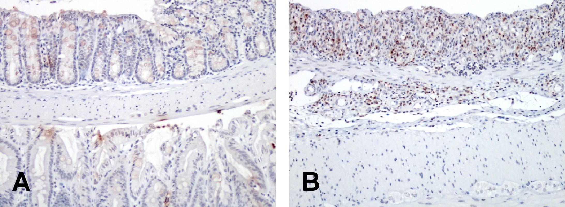 Mouse Ly-6G/Ly-6C (Gr-1) Antibody MAB1037