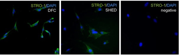 Human STRO‑1 Antibody MAB1038