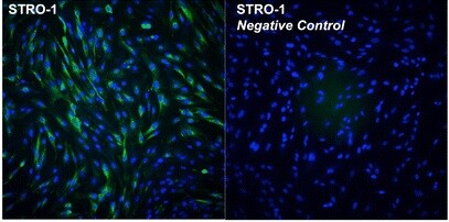 Human STRO‑1 Antibody MAB1038