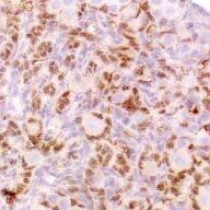 Human FOXL2 Antibody MAB10396