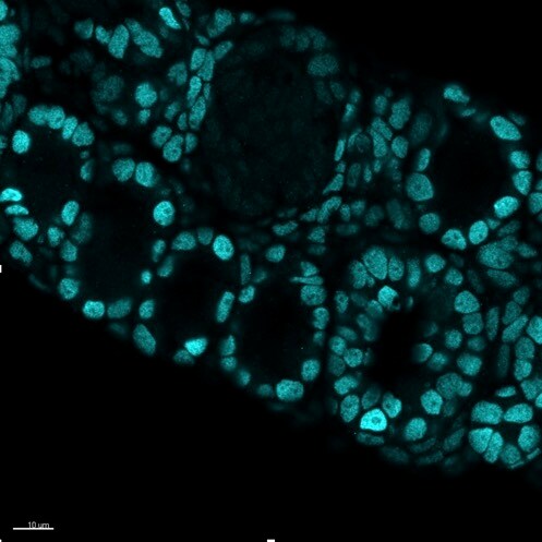 Human FOXL2 Antibody MAB10396