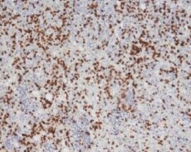 Human 2B4/CD244/SLAMF4 Antibody MAB1039